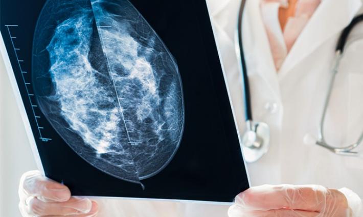 Doctor reading mammogram image